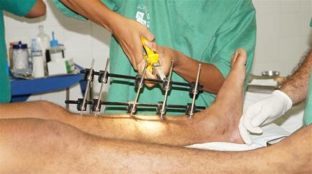 CIRURGIAS ORTOPÉDICAS